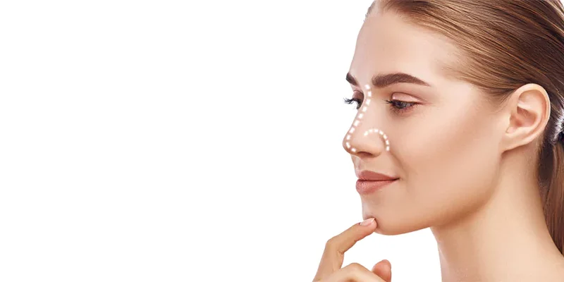 will rhinoplasty fail?